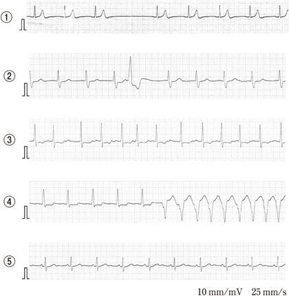 --pISj3hCPiLLlLeXZi7K