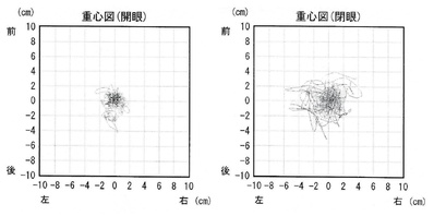 状況説明図