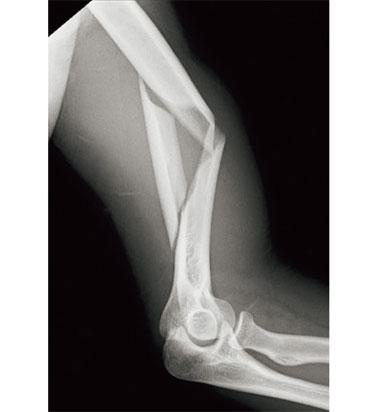 3Zp2A5x6xN4P04fcacQsT