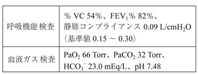 406zVhdf6-7TyCRDzvmqP