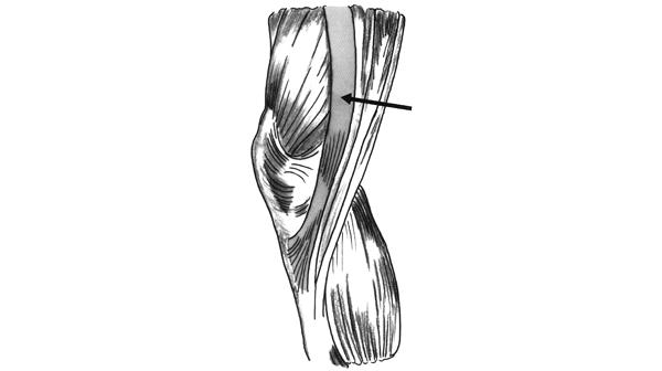 6D_SA_ochdhlSpC-6YeSN