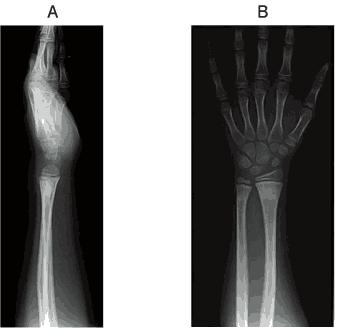 9WRntei6TO_fzuXSL_gvI