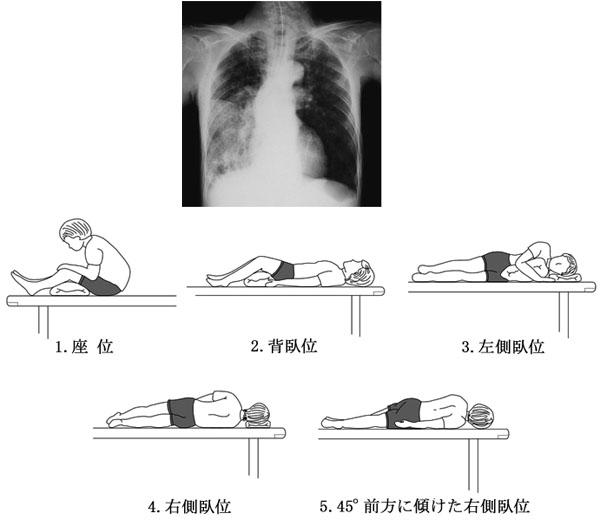 B8AWQg6p18-IvFlMMbZdV