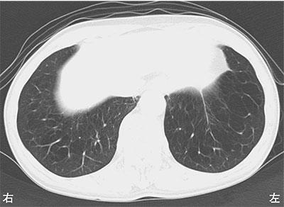 D7W_0y7oU6CU0iP48JizM