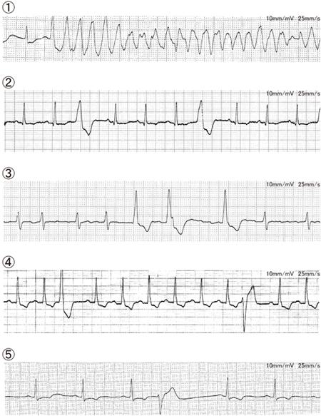 Dw980ddgFW75Z2DP60kzq