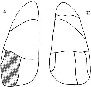 FgZDLU8KvPuWlSkZqyE_P