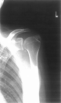 GhMRmPIzdAXsY-xpUG97S