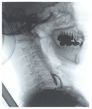 JgGsY4-aXF1k7bf9tJ5XM