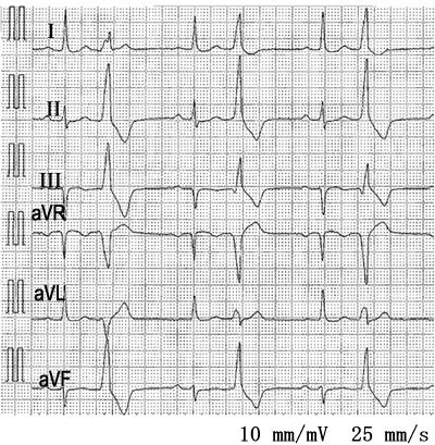KB6RDKTeQssR9-GG3VF7O