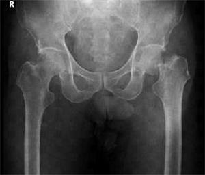 KHUzzmJlR3bjJWDT9XBYK