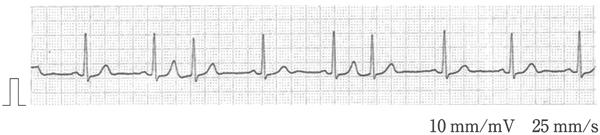LBg60V4S4kVKeSyJlAdRl