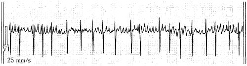 Lxomqf5milbBLYXJNDn6k