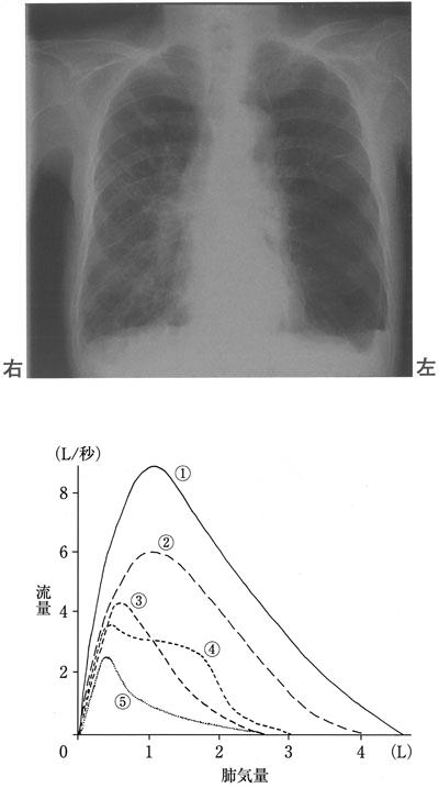 NVdWmRTT_HkyF83YkGV9T