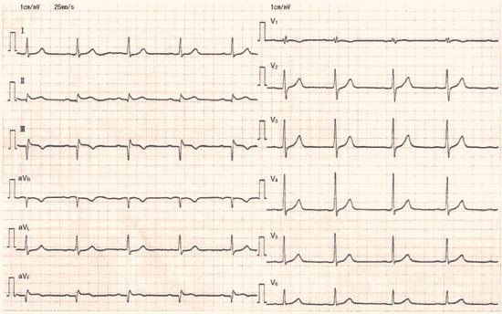 SXwOFGnxkB2gjmylBLgd-