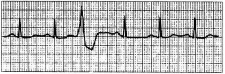 SjRccf9bFPs9UYu4orItC