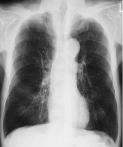 U1daFTIdZ0zJNWATh-r0E