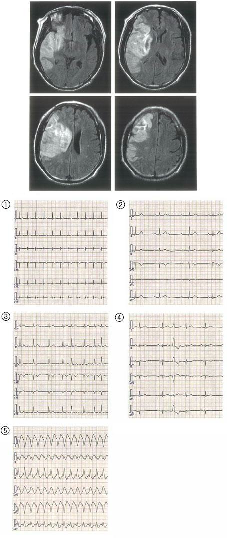 atG3TjiuC0WglLOPLZI_H
