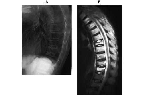 bCWUXyKZtJ-3e_GYvTrJF