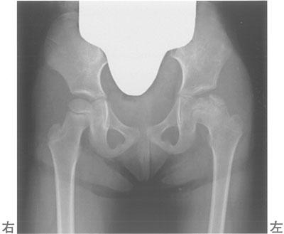 ehgG_Wl78DcAdsqIkvJpU