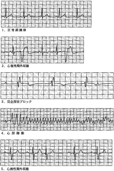 ixpgLdFT-IIP-oiTBox9Z