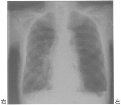 ktlqKBiQR0tqQ5Ch-Xn6v