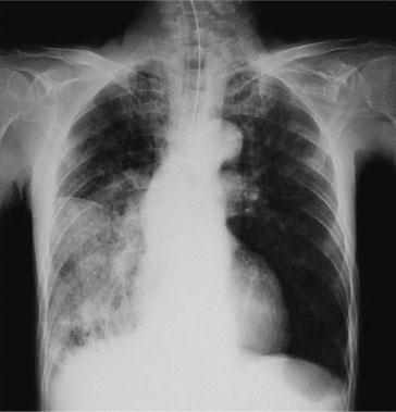 nOLchorDCdZ-nIOOv-U4P