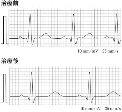 nQcaZjIc2mPDvlU1poHFc