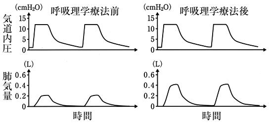 oxl9S8RD6ohyAcp0oOiCp