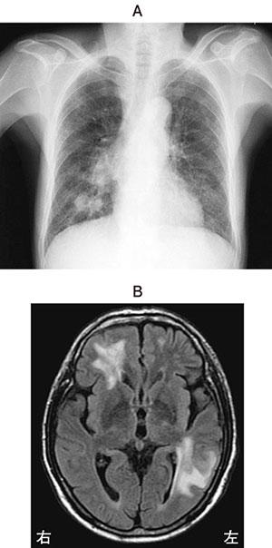 pt3_5lAZtyEKQ_ewgvbzS