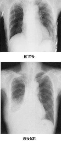 sixBwpIuh-1ln-TaI7CJE
