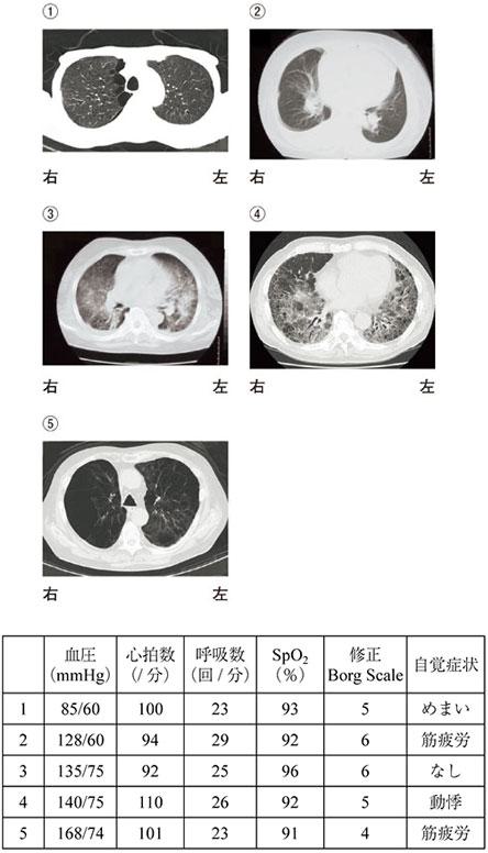 slX1rxlYQtvKe-nUht7tJ