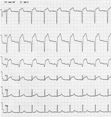 tfZuWVr2AFI2CKQCllzJz